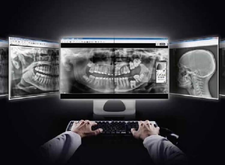 tomograf tomografia komputerowa zębów